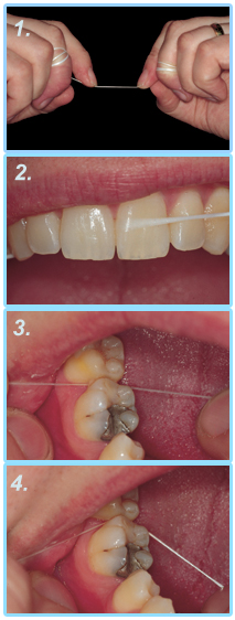 Floss instructions